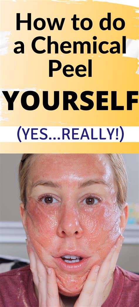 TCA Peel at Home: Benefits, Instructions, Side Effects and More.